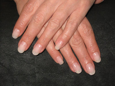 nail_fragen